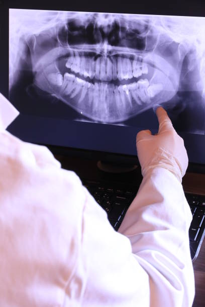Best Emergency Treatment for Dental Infections or Abscesses in Mount Carroll, IL
